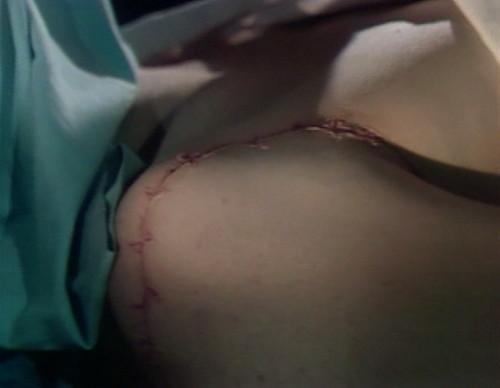 476 dark shadows scar monster