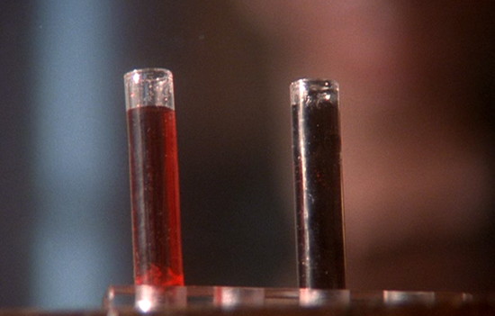 1991 dark shadows blood chemistry