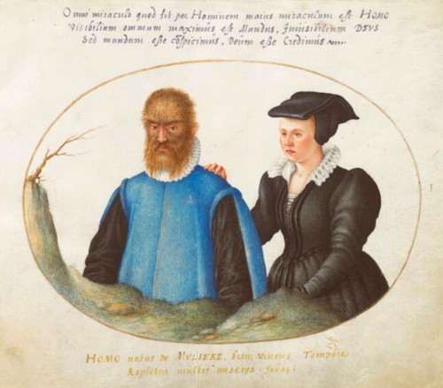 677 dark shadows hypertrichosis